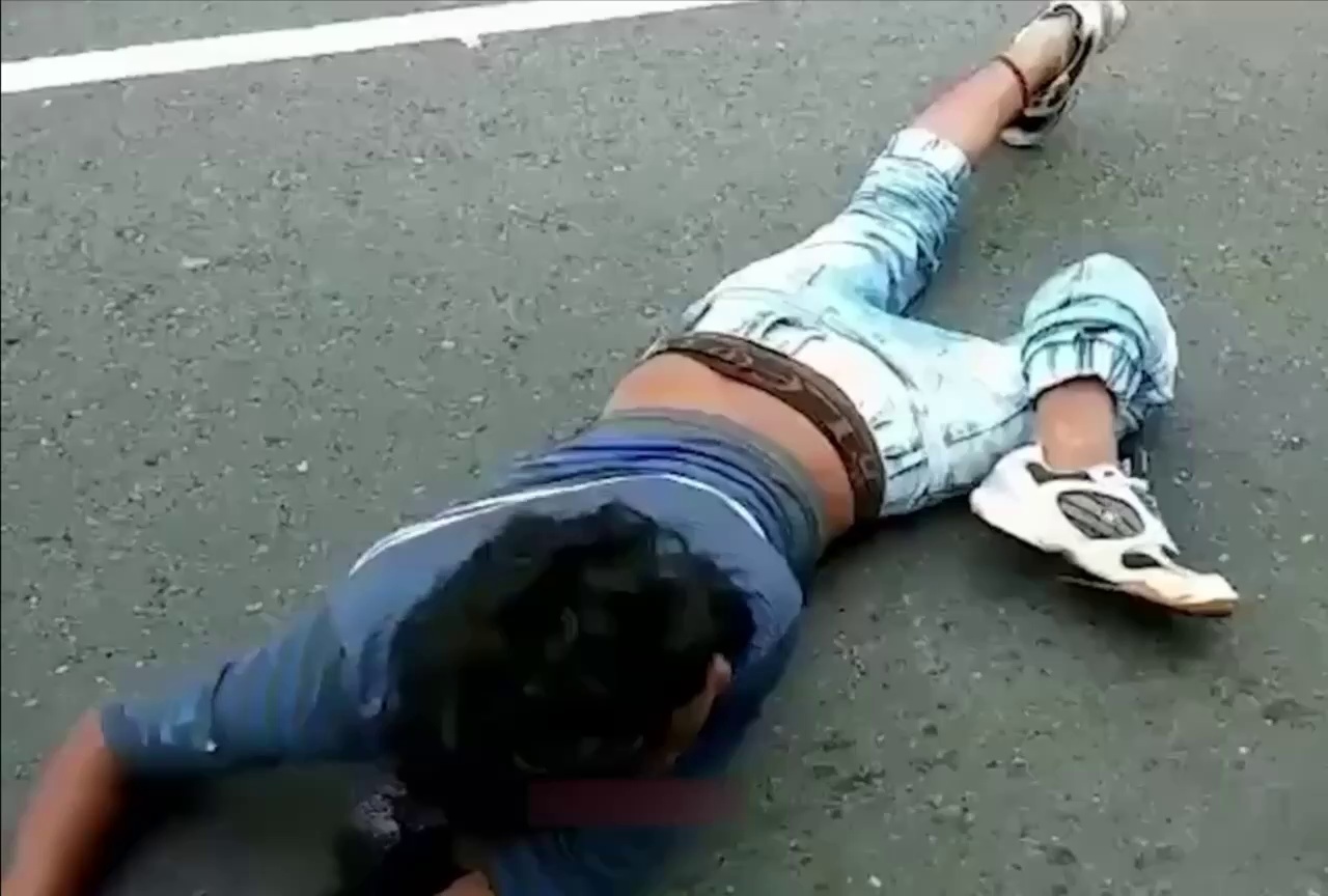 Young biker's leg gets twisted into a knot